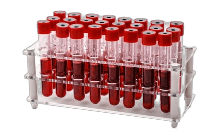 Biological specimens, non-infectious, in preservative solutions