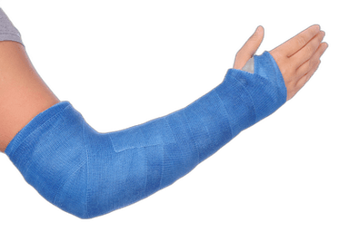 Casts